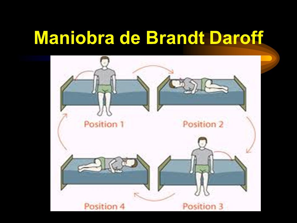 ejercicios de brandt-daroff